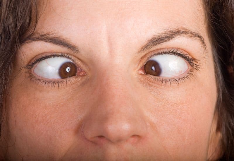 Lác ảnh hưởng tiêu cực đến diện mạo của người bệnh.