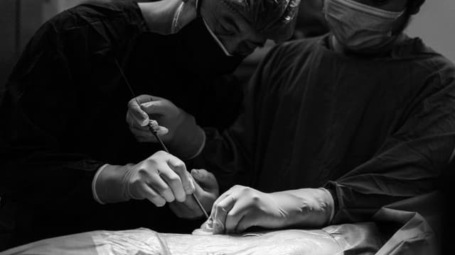 Tán sỏi qua da không mổ mở – “Cứu tinh” cho sỏi thận lớn tái phát