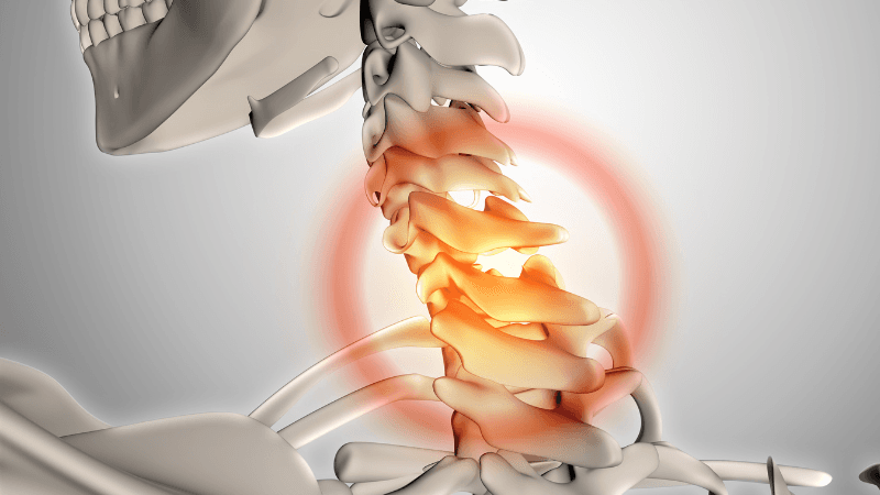 Vị trí đốt sống cổ C5 C6.