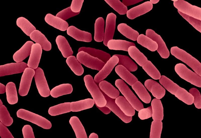 Nguyên nhân đau mắt đỏ là vi khuẩn