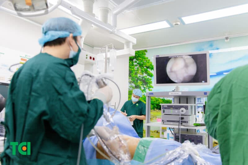 Sỏi thận tái phát kích thước lớn được xử gọn qua đường hầm mini