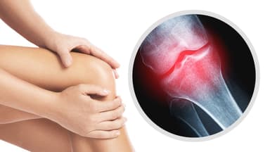 Tìm hiểu bệnh viêm khớp gối là gì