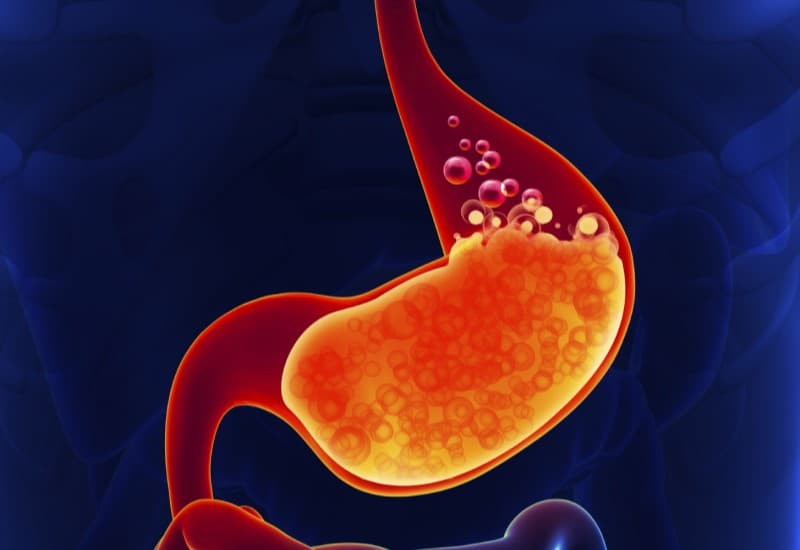 Triệu chứng rối loạn tiêu hóa do tăng tiết axit dạ dày và thông tin về thuốc gelactive fort