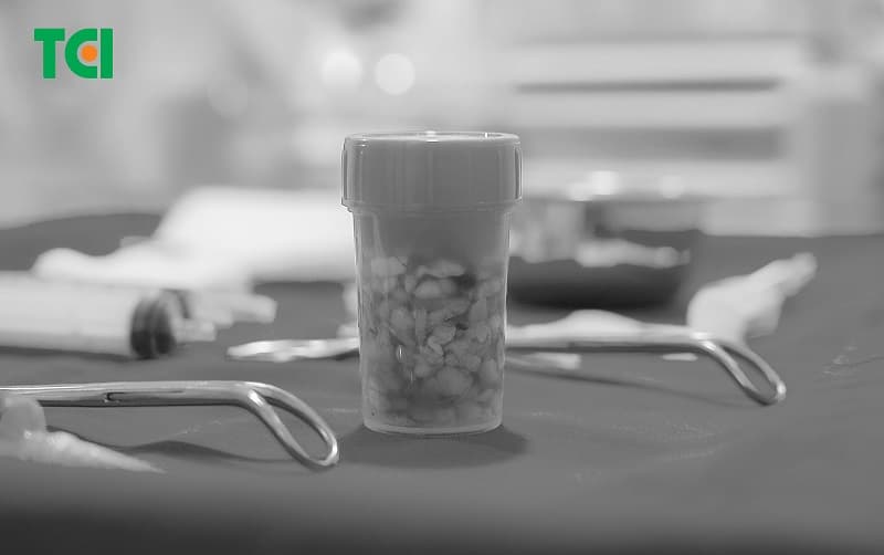 Hàng chục u vú được loại bỏ.