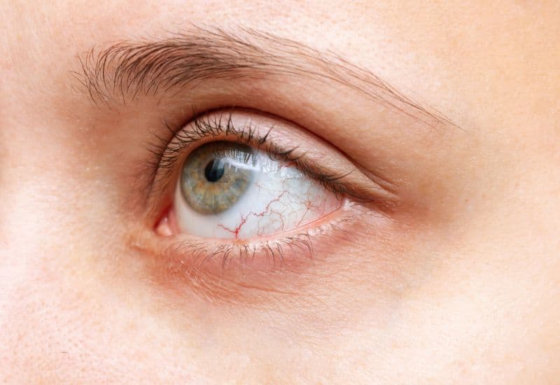 Từ sau ra trước của nhãn cầu, màng bồ đào bao gồm ba bộ phận là màng mạch, thể mi và mống mắt. Theo đó, viêm màng bồ đào mắt là bệnh lý nhãn khoa được xác định khi một trong ba hoặc cả ba bộ phận này của màng bồ đào nhiễm trùng. 