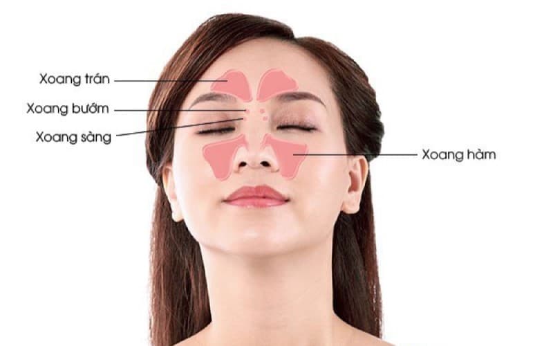 Triệu chứng viêm xoang mũi