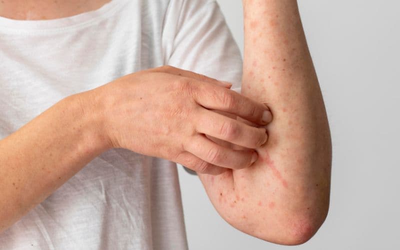 Thuốc này có thể được sử dụng để điều trị các bệnh về da.