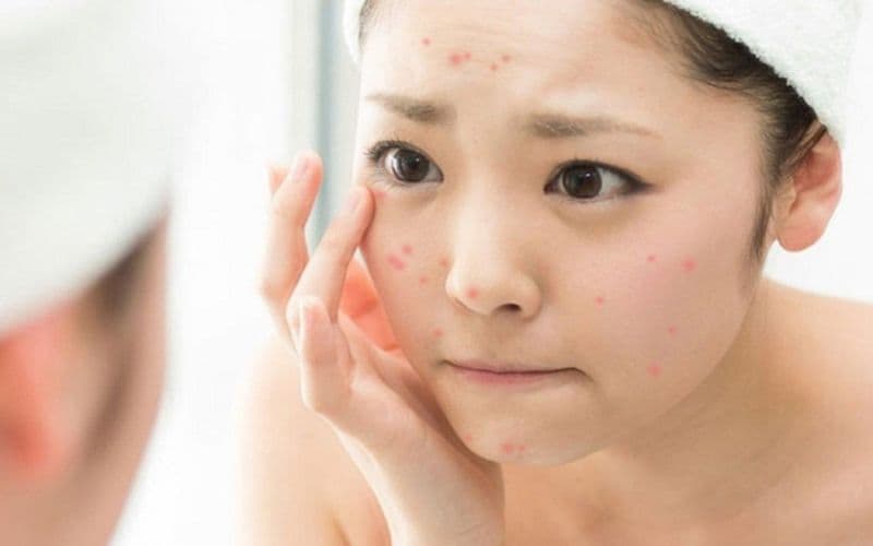 Sử dụng Niacinamide có thể giúp làm giảm tổn thương da