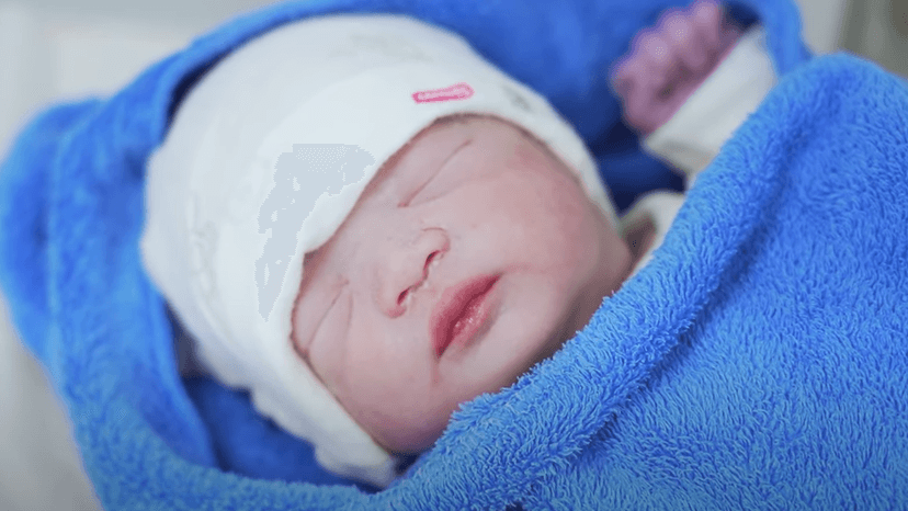 Sinh mổ kết hợp bóc tách u xơ tử cung to