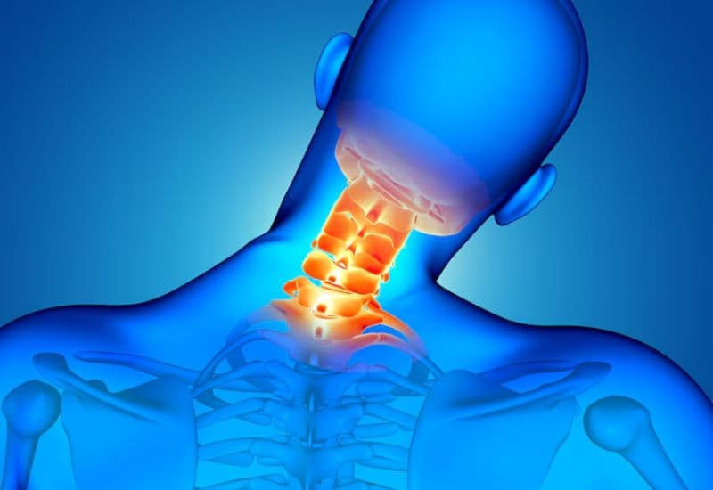 Thoái hoá đốt sống cổ gây ra hiện tượng dày xương dưới sụn, gai xương.