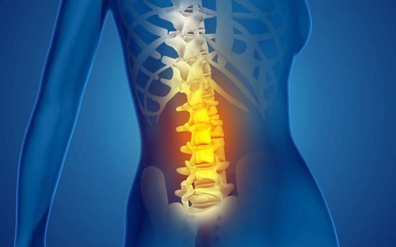 Thoái hoá đốt sống lưng là tình trạng thoái hoá của các đĩa đệm đốt sống.