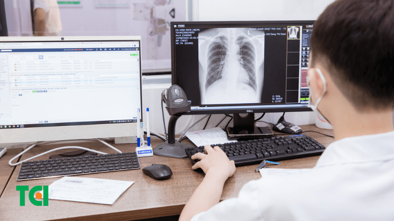 Chụp X-quang ngực có thể giúp chẩn đoán bệnh.