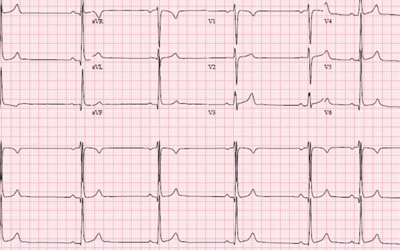 Cách đọc điện tâm đồ.
