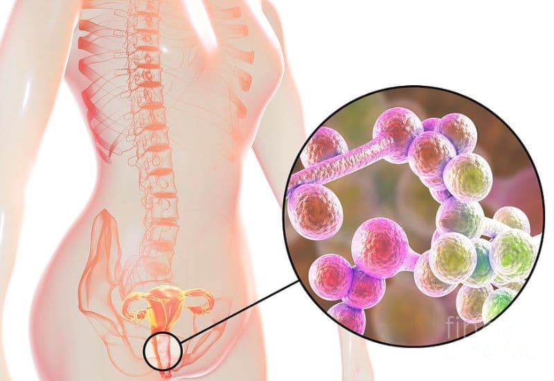 Viêm âm đạo sử dụng thuốc đặt Neo Tergynan