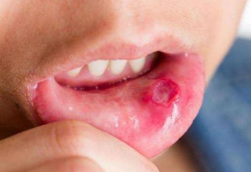 Hướng dẫn để sử dụng thuốc Kamistad hiệu quả hơn