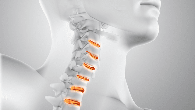 Tìm hiểu về xương đốt sống cổ và các bệnh lý liên quan