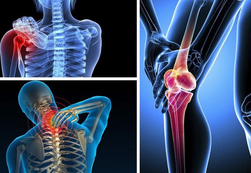 Các bệnh lý xương khớp điều trị bằng Piroxicam