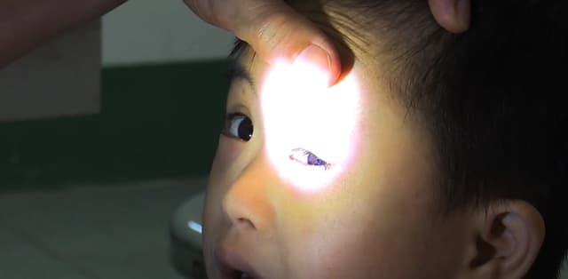 Đau mắt đỏ: Những nguyên nhân hàng đầu nên cảnh giác và cách điều trị