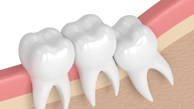 Tìm hiểu về giá nhổ răng số 8