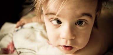 Tìm hiểu lác mắt là gì và cách phân loại, nhận biết, điều trị bệnh