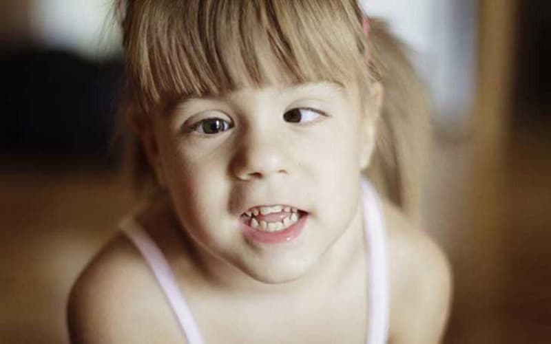 Có nhiều kiểu lác khác nhau