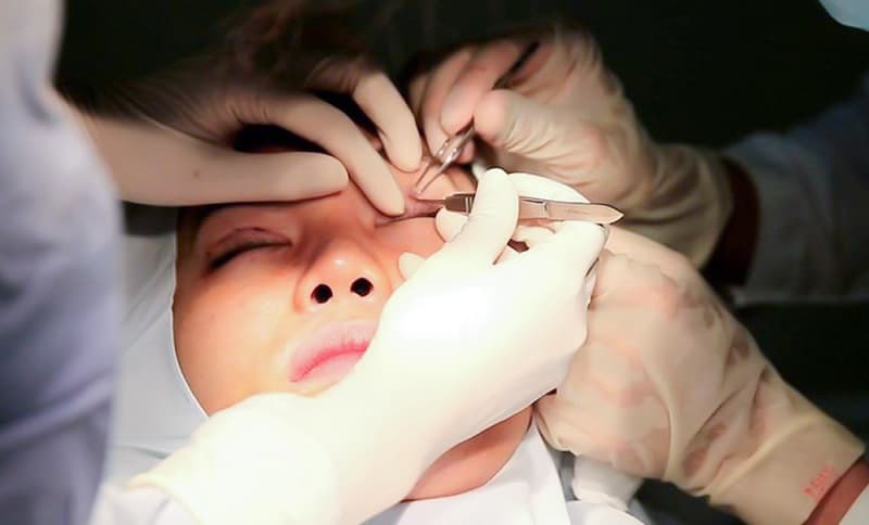 Khi phẫu thuật, một số bộ phận của mắt sẽ được điều chỉnh