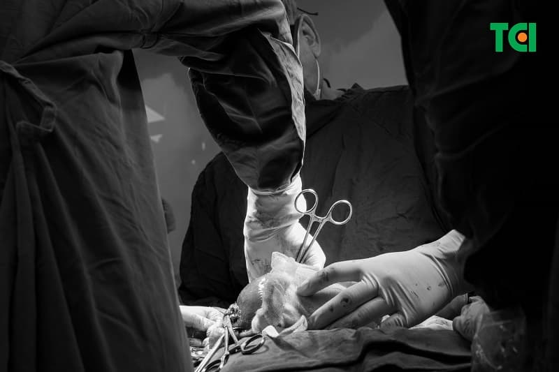 Bác sĩ phẫu thuật lấy thai kết hợp bóc tách khối u