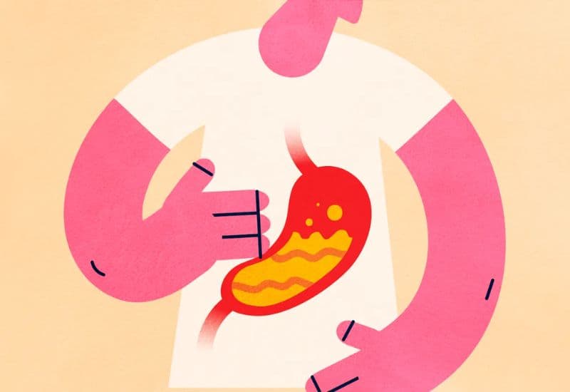 Khi nào cần đi thăm khám, kiểm tra xác định nguyên nhân ợ chua?