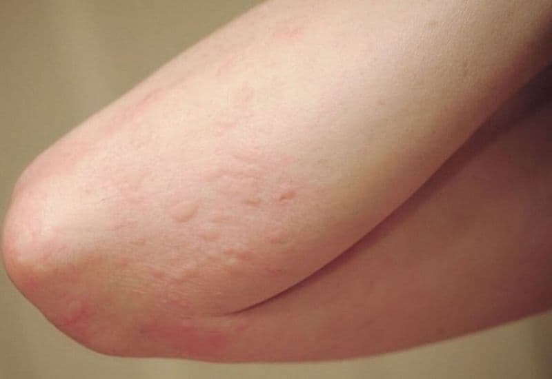 Cần lưu ý gì khi sử dụng thuốc