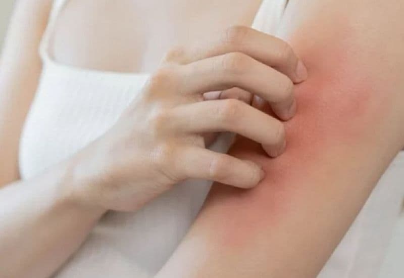 Tìm hiểu về thuốc promethazin