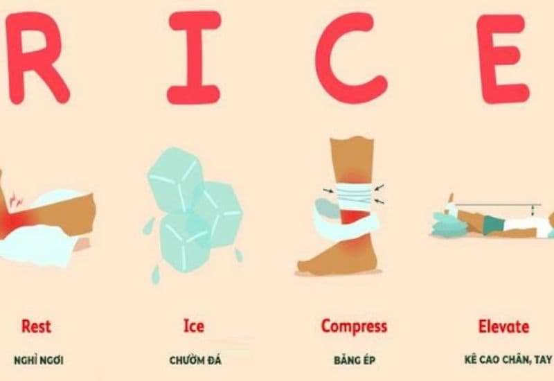 RICE phương pháp sơ cứu chấn thương phần mềm