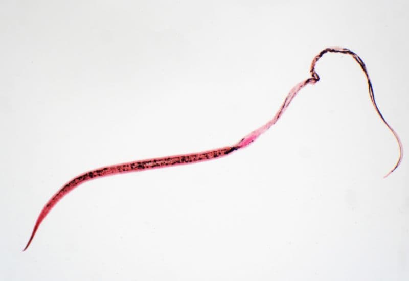 Ký sinh trung có thể là một trong những nguyên nhân khiến trẻ không hấp thụ đủ chất dinh dưỡng, dẫn đến suy dinh dưỡng. 