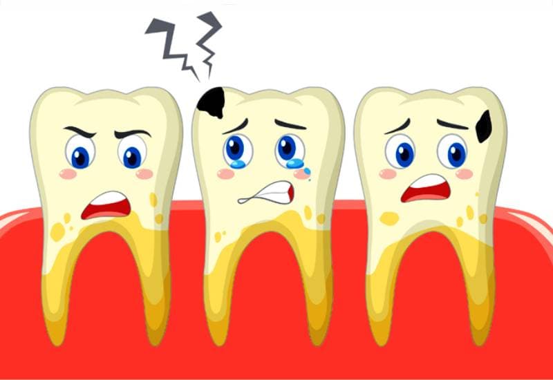 tìm hiểu tại sao lại sâu răng
