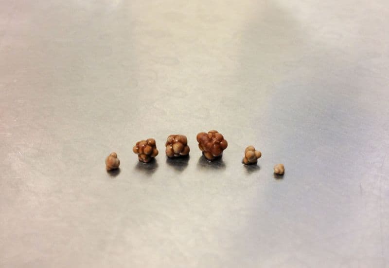 Khi nào Rowatinex được chỉ định sử dụng?