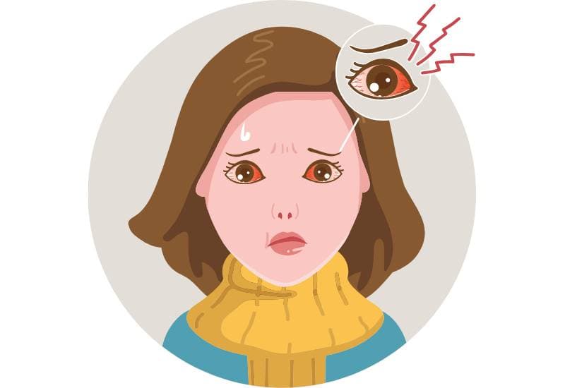 Đỏ mắt: Triệu chứng đau mắt đỏ phổ biến nhất