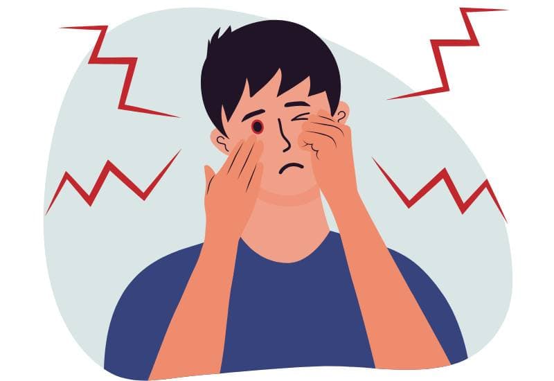 Trong một số trường hợp nghiêm trọng, đau mắt đỏ có thể gây suy giảm thị lực tạm thời.