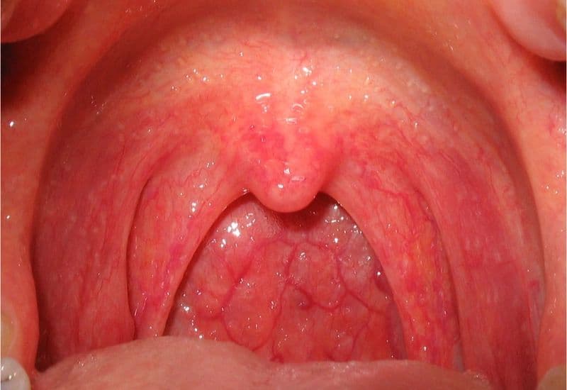 Các thông tin cần biết trước khi sử dụng viên ngậm Mekotricin