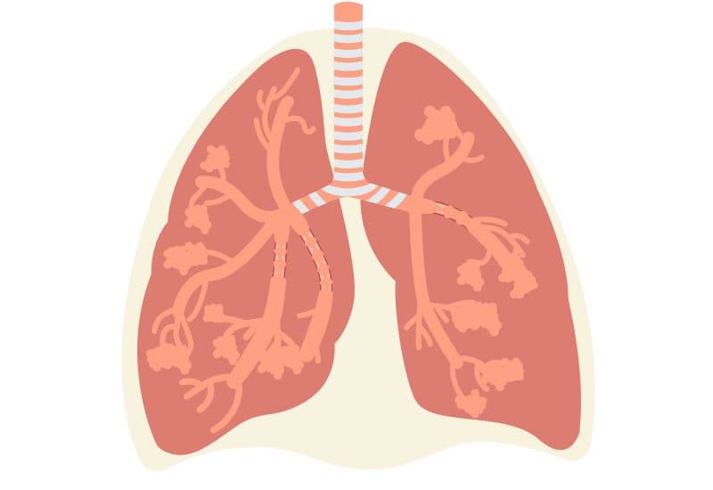 Phế quản là một phần của hệ hô hấp, có chức năng chính là dẫn khí vào - ra khỏi phổi và lọc không khí, giữ cho phổi ẩm. 