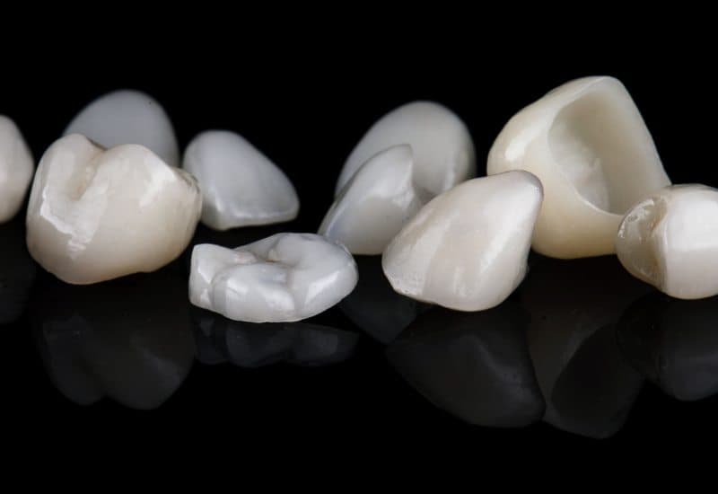 Bọc sứ là phương pháp nha khoa mà trong đó, một mão sứ, được thiết kế để bao phủ hoàn toàn răng tự nhiên, từ đó giúp cải thiện hình dạng, màu sắc và kích thước của răng.