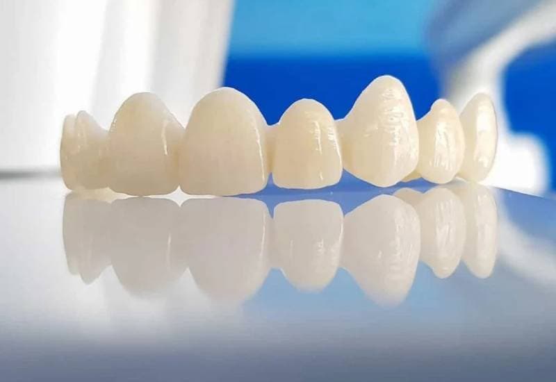 Có nên bọc răng sứ không ạ