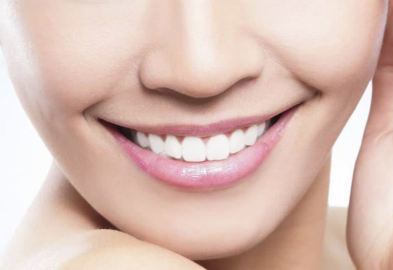 Dán sứ Veneer giá bao nhiêu 1 răng tại bệnh viện trung ương