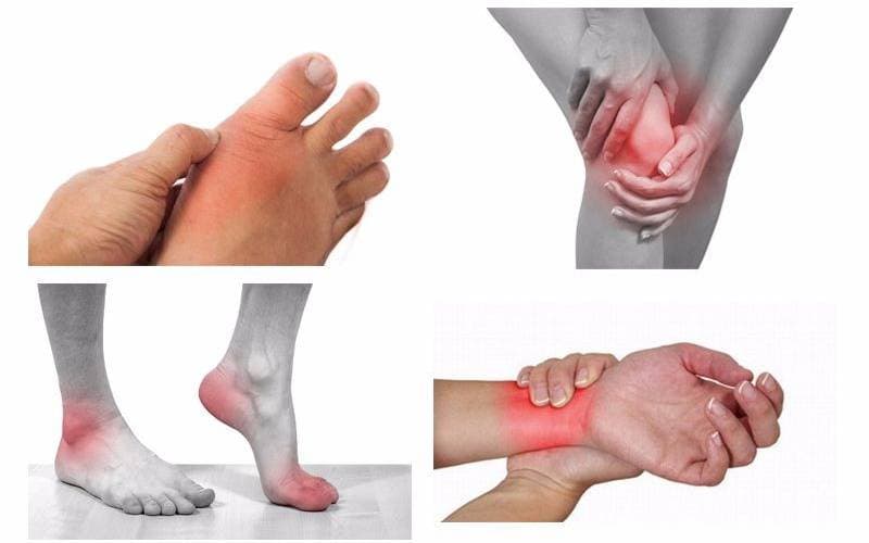 dexamethasone điều trị bệnh gì