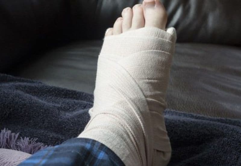 dấu hiệu nhận biết gãy xương kín