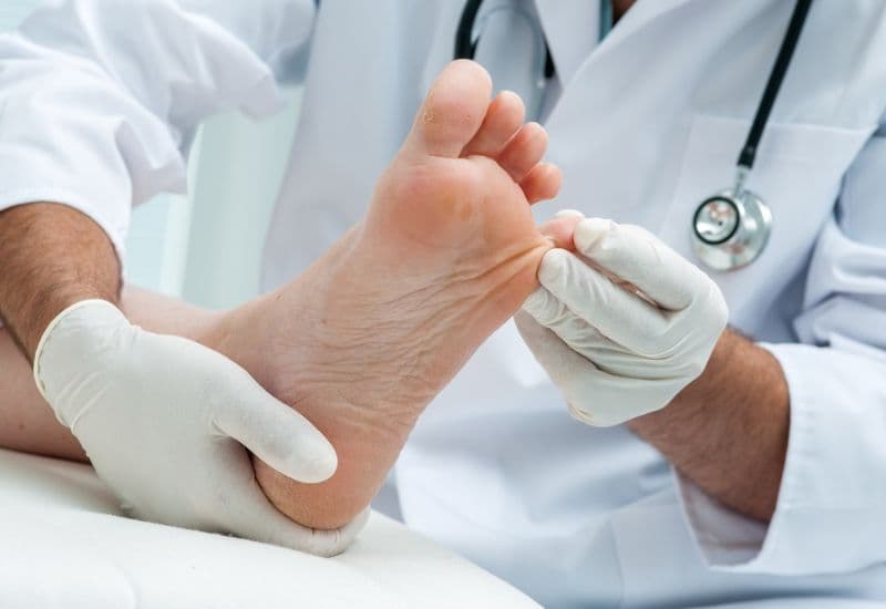 Điều trị bệnh móng quặp