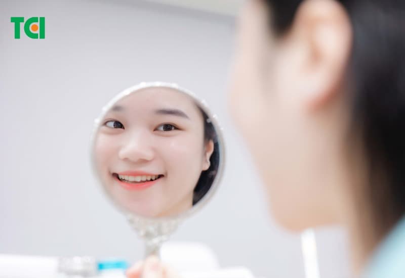 Quy trình dán sứ veneer trong nha khoa thường bao gồm 6 bước cơ bản.