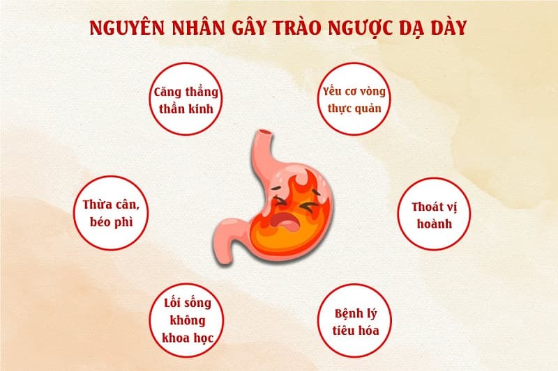 Nguyên nhân gây trào ngược dạ dày thực quản