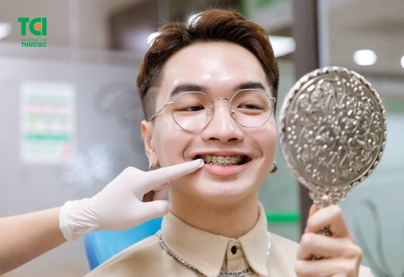 tìm hiểu Niềng răng mất bao lâu