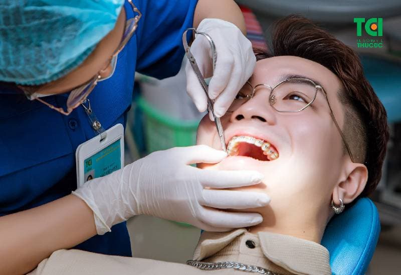 Niềng răng pha lê khám như thế nào