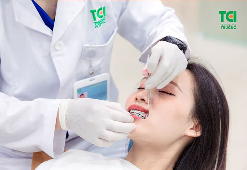 Niềng răng trước và sau là gì