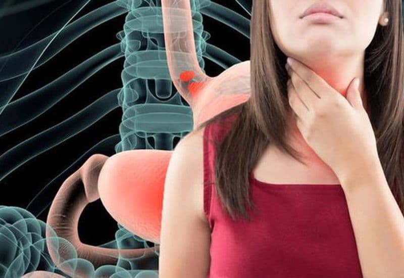 Ợ chua nóng cổ là tình trạng gì?
